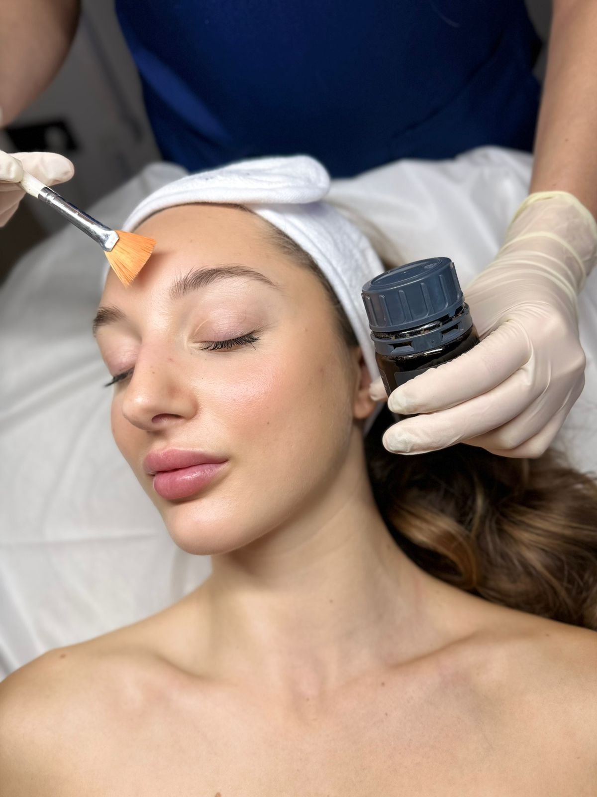 Θεραπείες για Μελάσμα